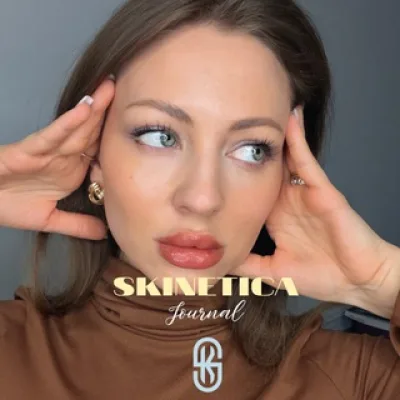 СКИНЕТИКА